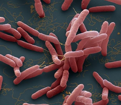 Bộ Y tế khuyến cáo cộng đồng cách phòng bệnh" Vi khuẩn ăn thịt người" Phụ huynh cần biết.